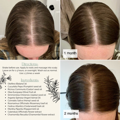 Botanical Hair & Scalp Oil