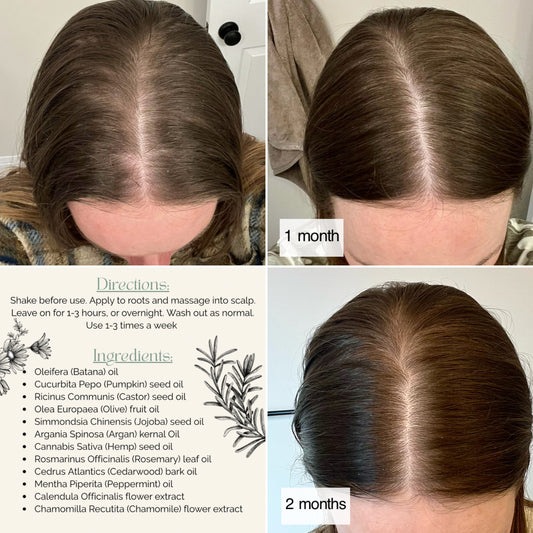 Botanical Hair & Scalp Oil